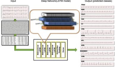 Usefulness of Machine Learning Based Detection and Classification of Cardiac Arrhythmias with 12 Lead Electrocardiograms